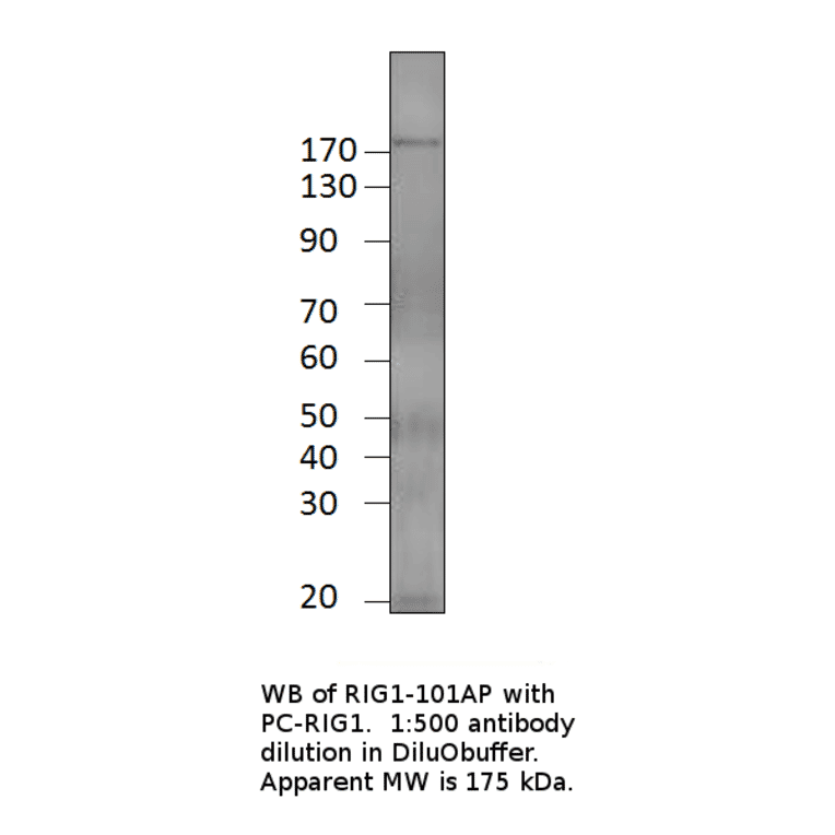 Anti-Robo3 Antibody from FabGennix (RIG1-101AP) - Antibodies.com