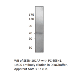Anti-SESN1 Antibody from FabGennix (SESN-101AP) - Antibodies.com