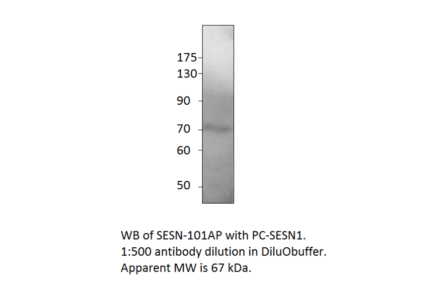 Anti-SESN1 Antibody from FabGennix (SESN-101AP) - Antibodies.com