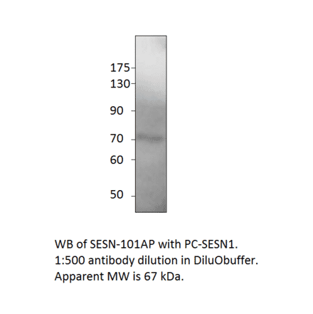 Anti-SESN1 Antibody from FabGennix (SESN-101AP) - Antibodies.com