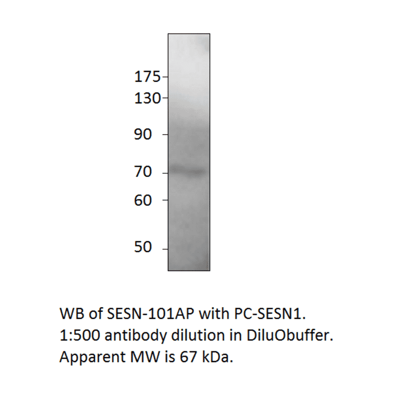 Anti-SESN1 Antibody from FabGennix (SESN-101AP) - Antibodies.com