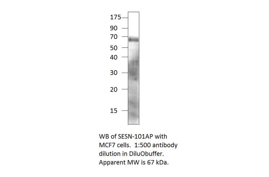 Anti-SESN1 Antibody from FabGennix (SESN-101AP) - Antibodies.com