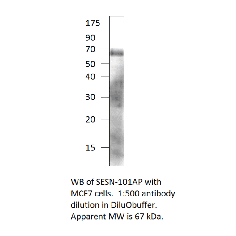 Anti-SESN1 Antibody from FabGennix (SESN-101AP) - Antibodies.com