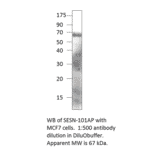 Anti-SESN1 Antibody from FabGennix (SESN-101AP) - Antibodies.com
