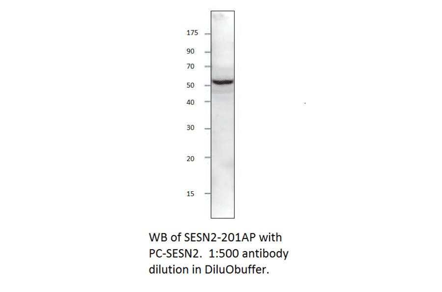 Anti-SESN2 Antibody from FabGennix (SESN-201AP) - Antibodies.com