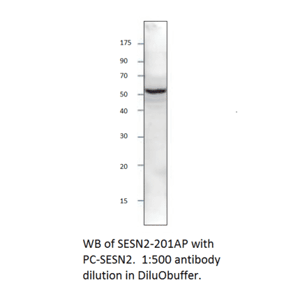 Anti-SESN2 Antibody from FabGennix (SESN-201AP) - Antibodies.com