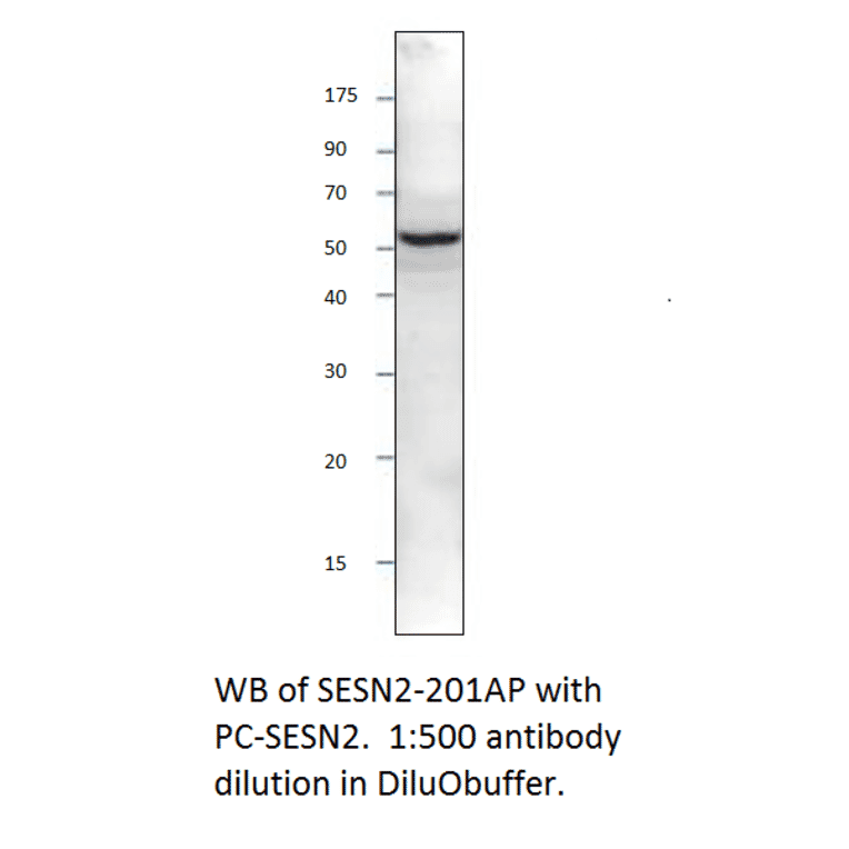 Anti-SESN2 Antibody from FabGennix (SESN-201AP) - Antibodies.com