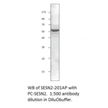 Anti-SESN2 Antibody from FabGennix (SESN-201AP) - Antibodies.com