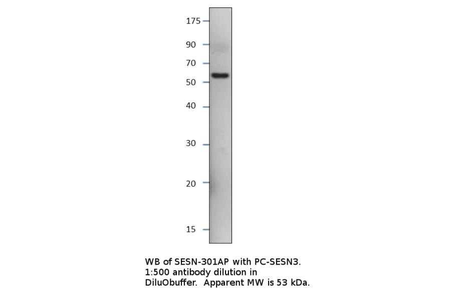Anti-SESN3 Antibody from FabGennix (SESN-301AP) - Antibodies.com