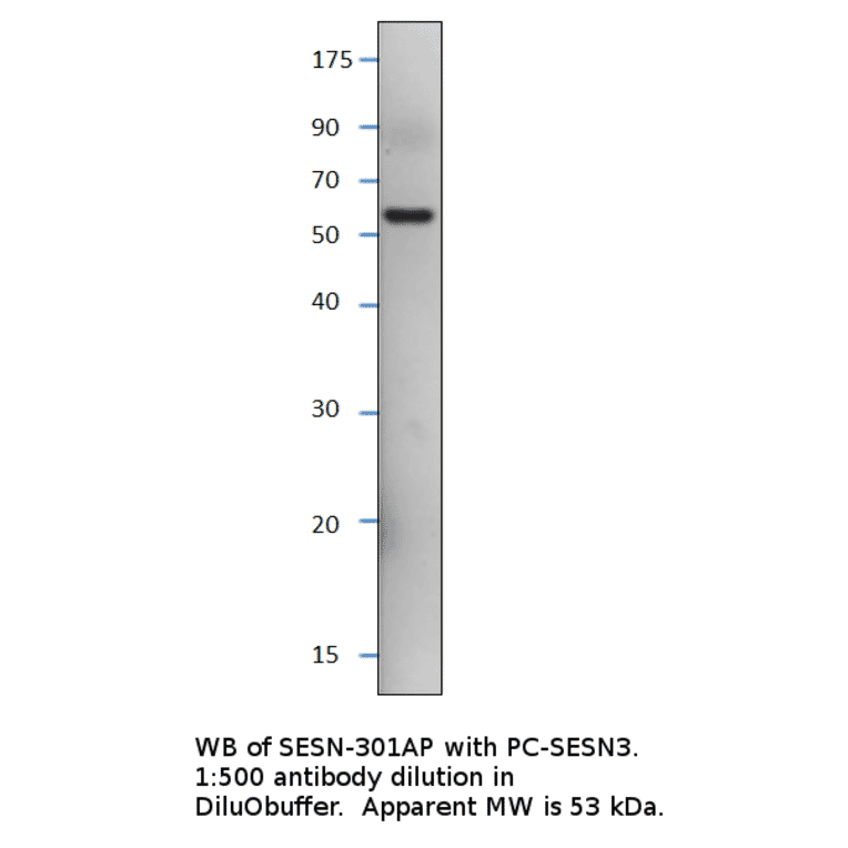Anti-SESN3 Antibody from FabGennix (SESN-301AP) - Antibodies.com