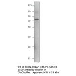 Anti-SESN3 Antibody from FabGennix (SESN-301AP) - Antibodies.com