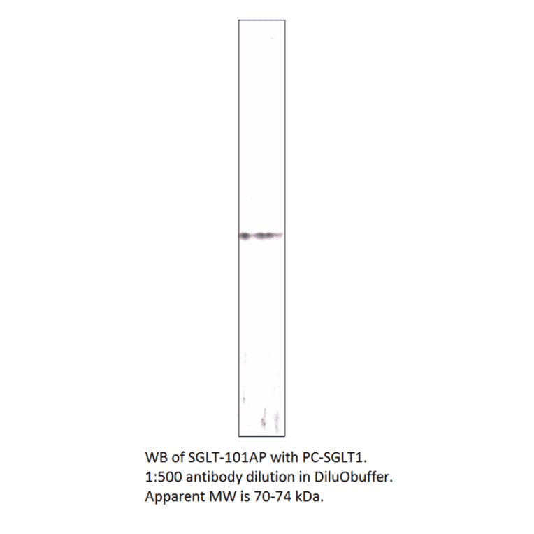 Anti-SGLT1 Antibody from FabGennix (SGLT-101AP) - Antibodies.com