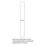 Anti-SGLT1 Antibody from FabGennix (SGLT-101AP) - Antibodies.com