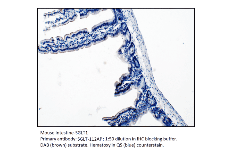 Anti-SGLT1 Antibody from FabGennix (SGLT-112AP) - Antibodies.com