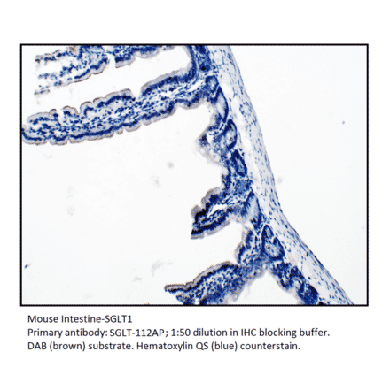 Anti-SGLT1 Antibody from FabGennix (SGLT-112AP) - Antibodies.com