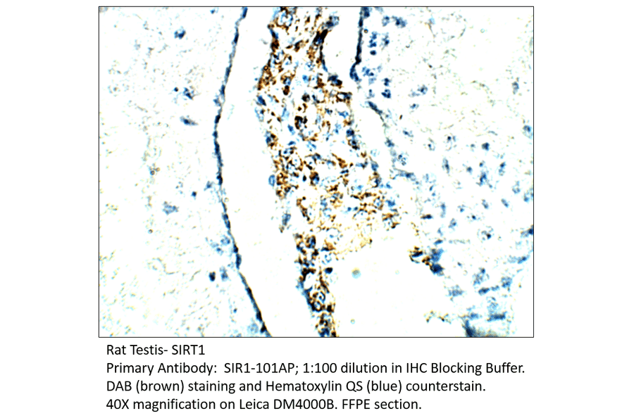 Anti-SIRT1 Antibody from FabGennix (SIR1-101AP) - Antibodies.com
