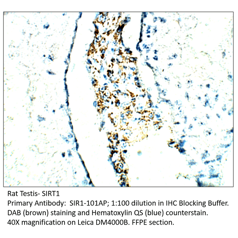 Anti-SIRT1 Antibody from FabGennix (SIR1-101AP) - Antibodies.com