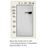 Anti-SIRT1 Antibody from FabGennix (SIR1-101AP) - Antibodies.com
