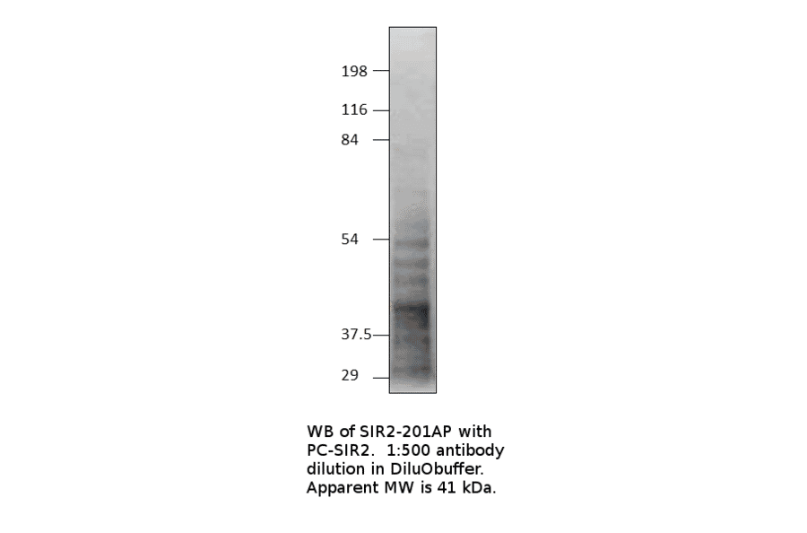 Anti-SIRT2 Antibody from FabGennix (SIR2-201AP) - Antibodies.com