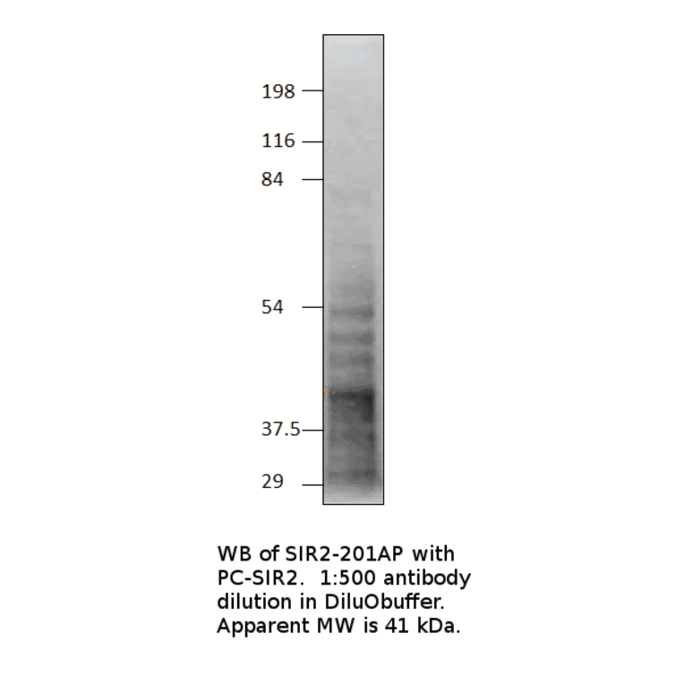 Anti-SIRT2 Antibody from FabGennix (SIR2-201AP) - Antibodies.com