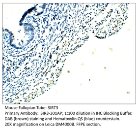 Anti-SIRT3 Antibody from FabGennix (SIR3-301AP) - Antibodies.com