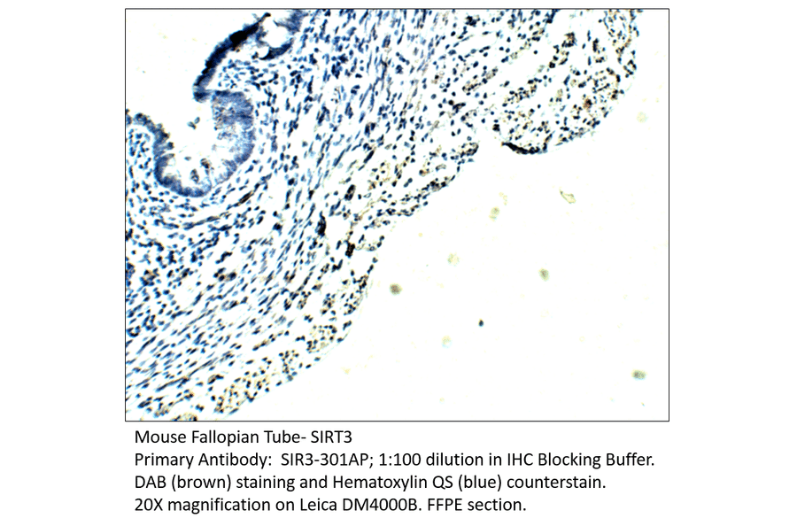 Anti-SIRT3 Antibody from FabGennix (SIR3-301AP) - Antibodies.com