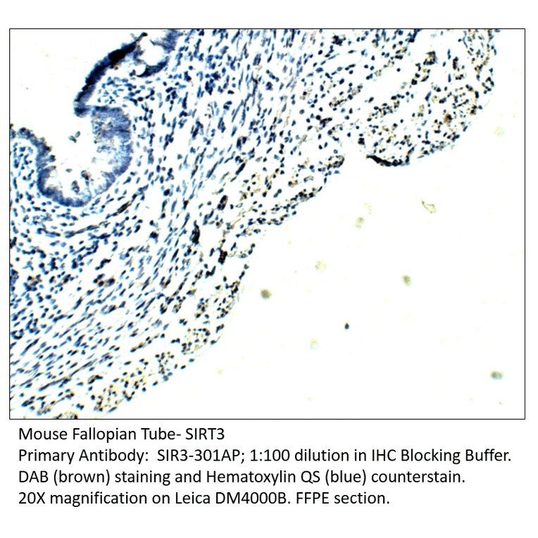 Anti-SIRT3 Antibody from FabGennix (SIR3-301AP) - Antibodies.com