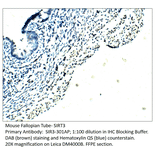 Anti-SIRT3 Antibody from FabGennix (SIR3-301AP) - Antibodies.com