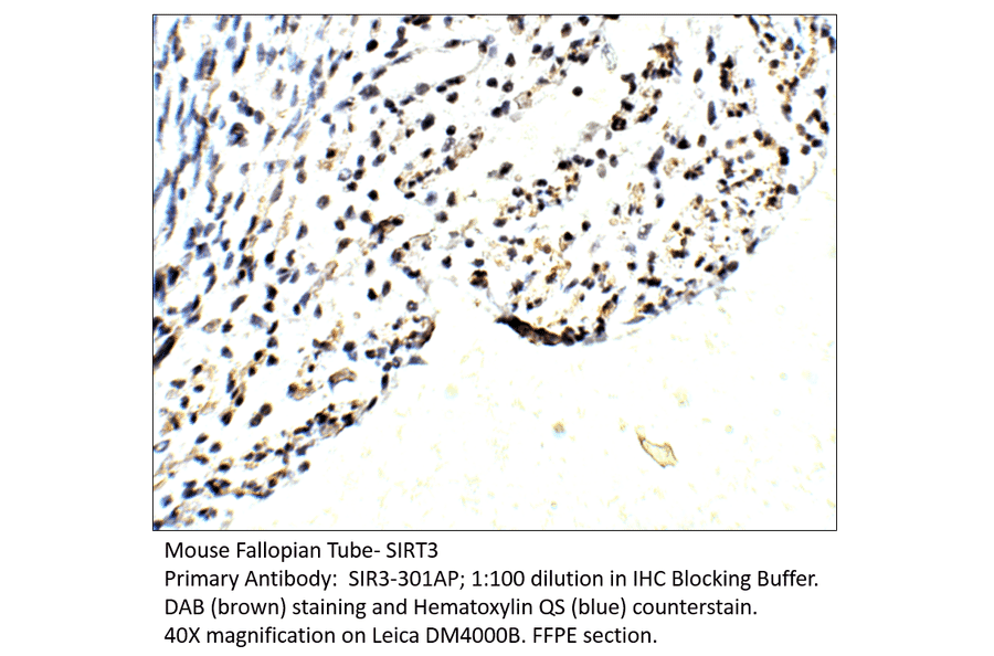 Anti-SIRT3 Antibody from FabGennix (SIR3-301AP) - Antibodies.com
