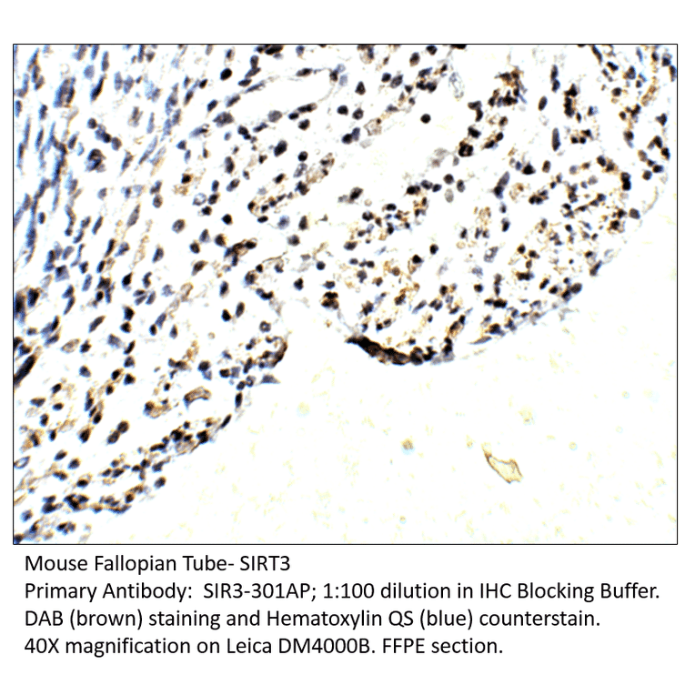 Anti-SIRT3 Antibody from FabGennix (SIR3-301AP) - Antibodies.com