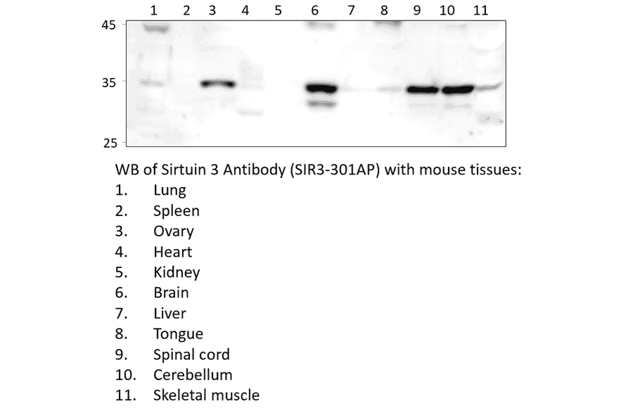 Anti-SIRT3 Antibody from FabGennix (SIR3-301AP) - Antibodies.com