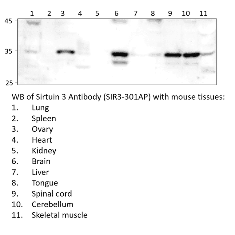 Anti-SIRT3 Antibody from FabGennix (SIR3-301AP) - Antibodies.com