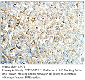 Anti-STAT6 Antibody from FabGennix (STAT6-101Y) - Antibodies.com