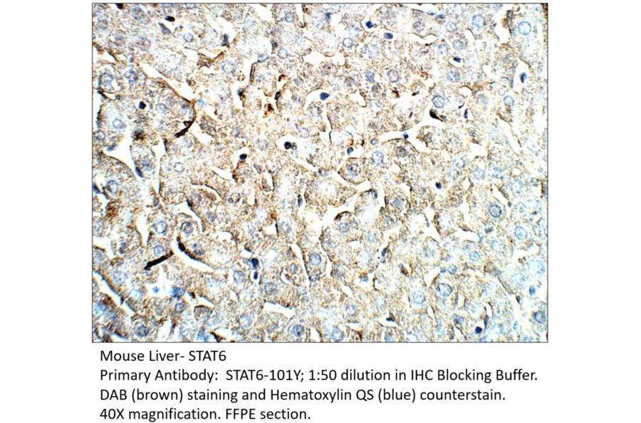 Anti-STAT6 Antibody from FabGennix (STAT6-101Y) - Antibodies.com