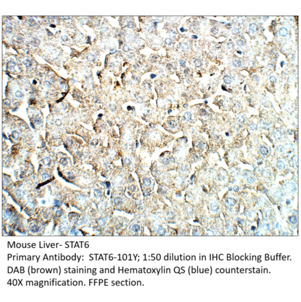 Anti-STAT6 Antibody from FabGennix (STAT6-101Y) - Antibodies.com
