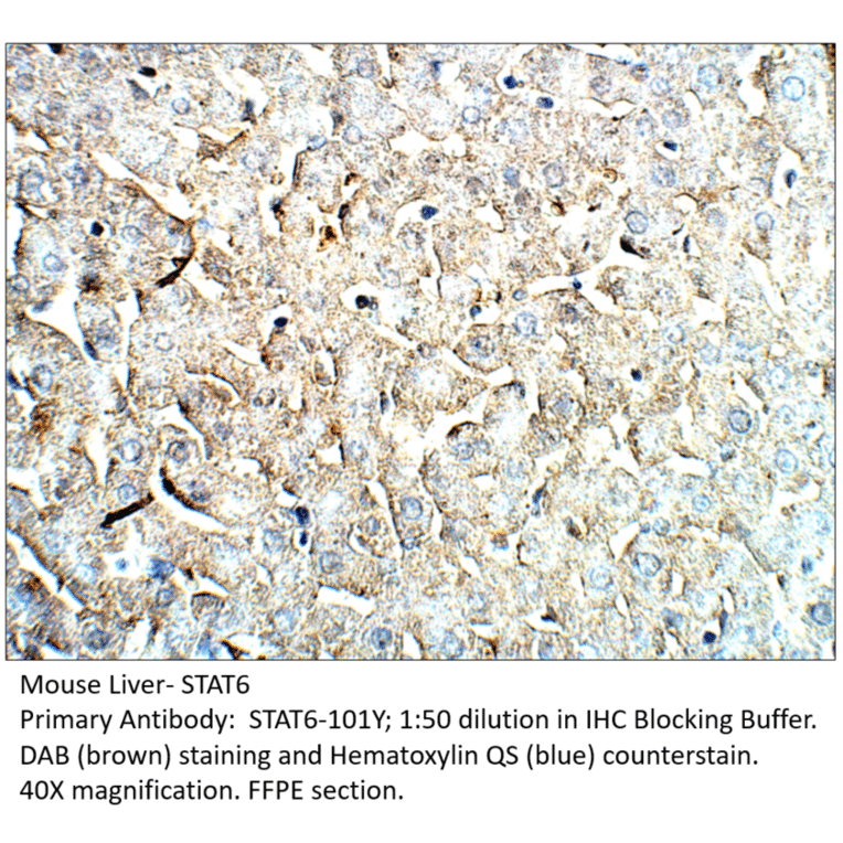 Anti-STAT6 Antibody from FabGennix (STAT6-101Y) - Antibodies.com