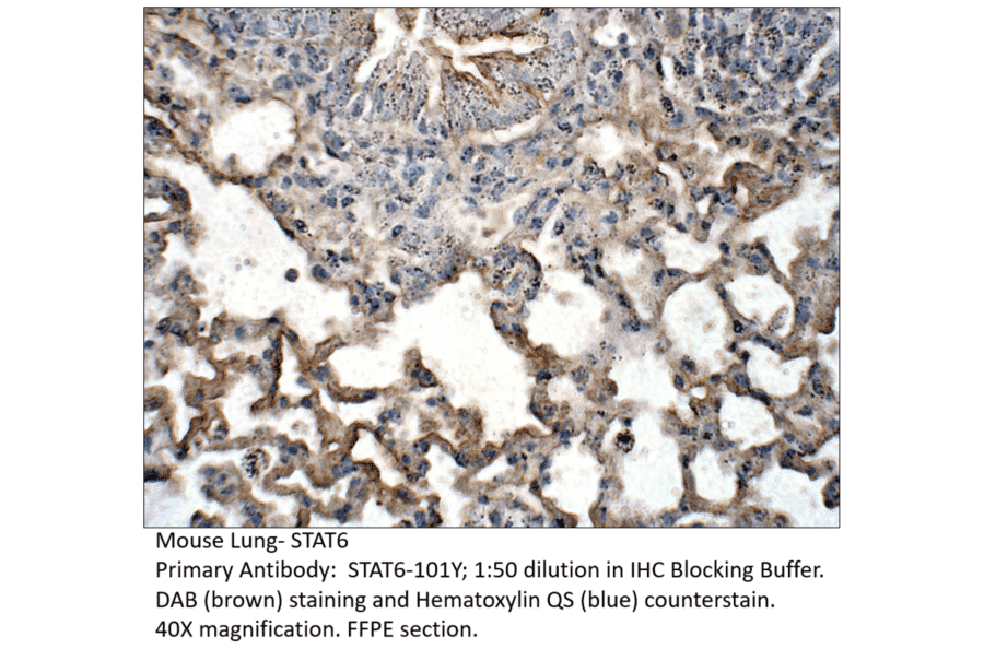 Anti-STAT6 Antibody from FabGennix (STAT6-101Y) - Antibodies.com