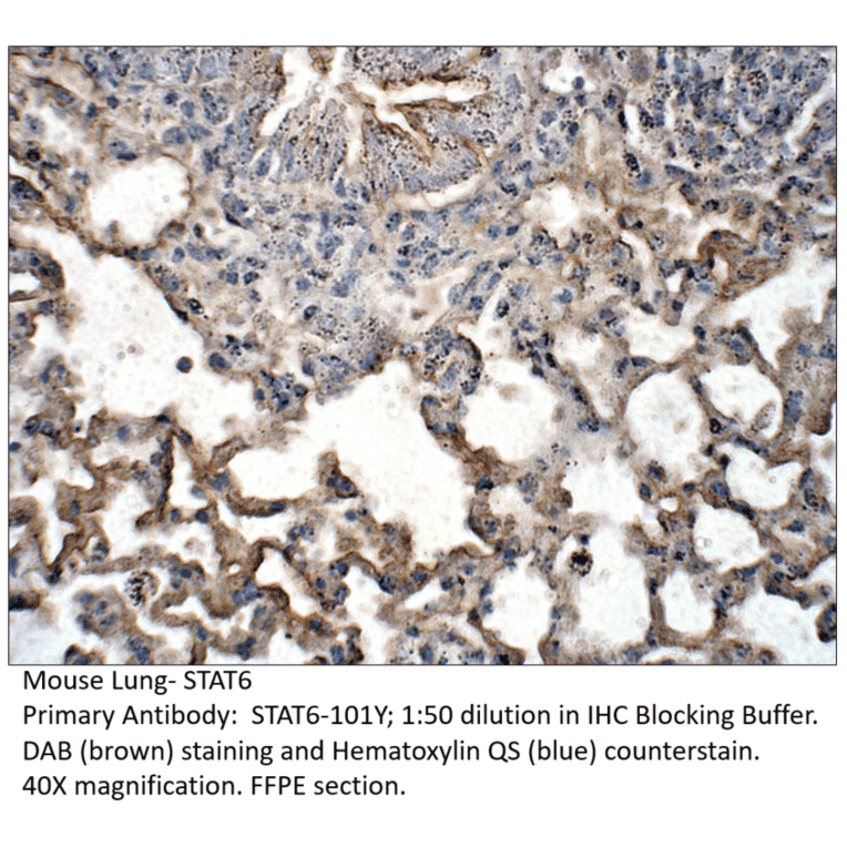 Anti-STAT6 Antibody from FabGennix (STAT6-101Y) - Antibodies.com