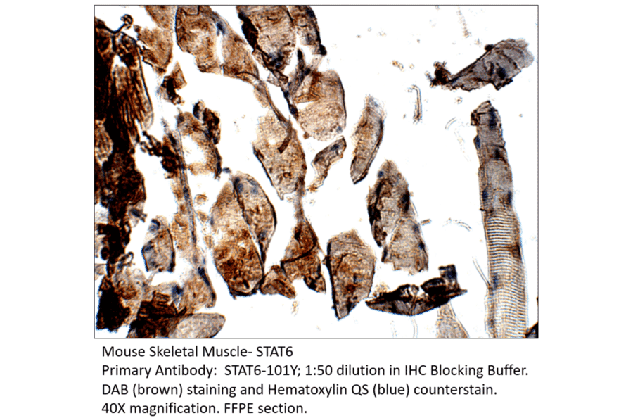 Anti-STAT6 Antibody from FabGennix (STAT6-101Y) - Antibodies.com