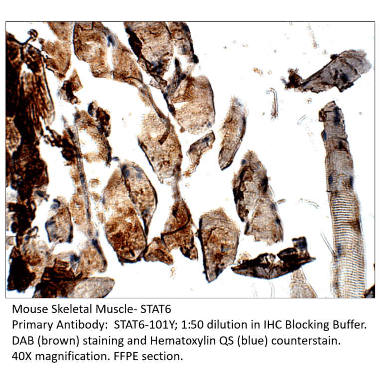 Anti-STAT6 Antibody from FabGennix (STAT6-101Y) - Antibodies.com