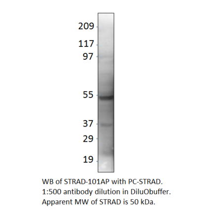 Anti-LYK5 Antibody from FabGennix (STRAD-101AP) - Antibodies.com