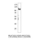 Anti-TLR11 Antibody from FabGennix (TLR-1101AP) - Antibodies.com