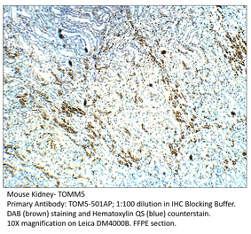 Anti-TOMM5 Antibody from FabGennix (TOM5-501AP) - Antibodies.com