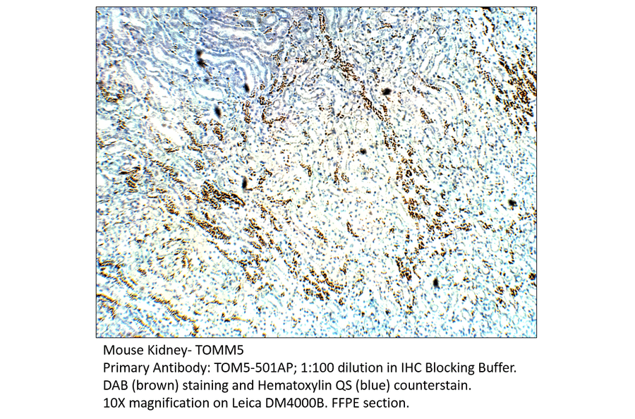 Anti-TOMM5 Antibody from FabGennix (TOM5-501AP) - Antibodies.com