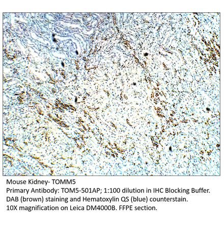 Anti-TOMM5 Antibody from FabGennix (TOM5-501AP) - Antibodies.com