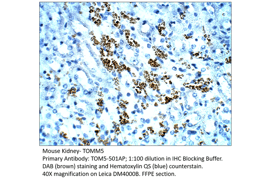 Anti-TOMM5 Antibody from FabGennix (TOM5-501AP) - Antibodies.com