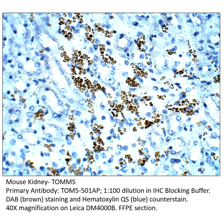 Anti-TOMM5 Antibody from FabGennix (TOM5-501AP) - Antibodies.com