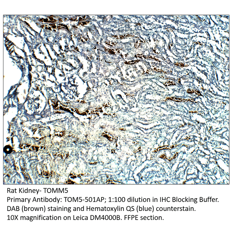 Anti-TOMM5 Antibody from FabGennix (TOM5-501AP) - Antibodies.com