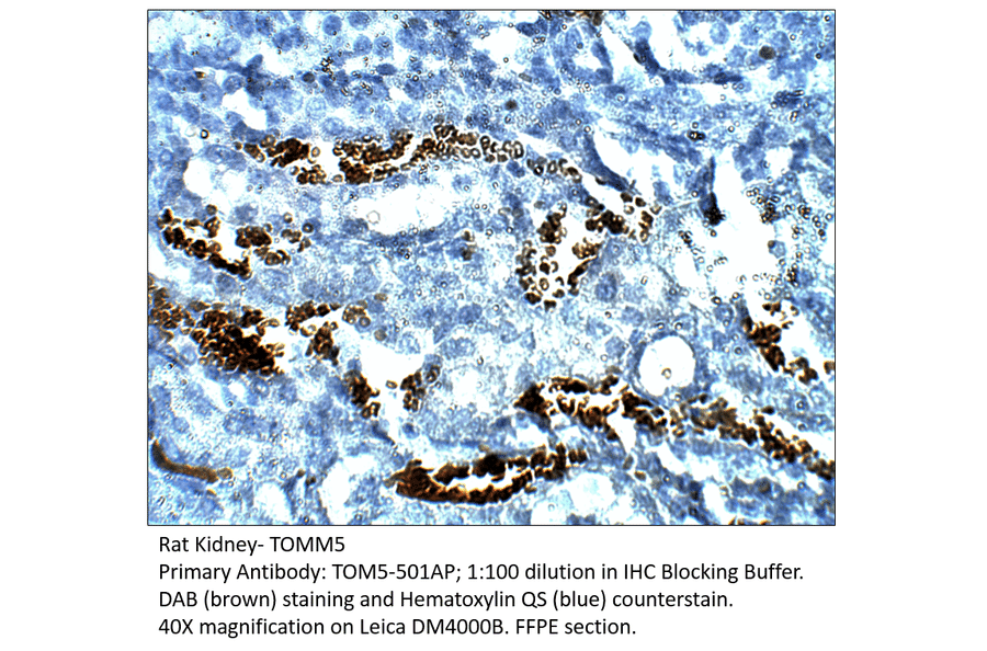 Anti-TOMM5 Antibody from FabGennix (TOM5-501AP) - Antibodies.com