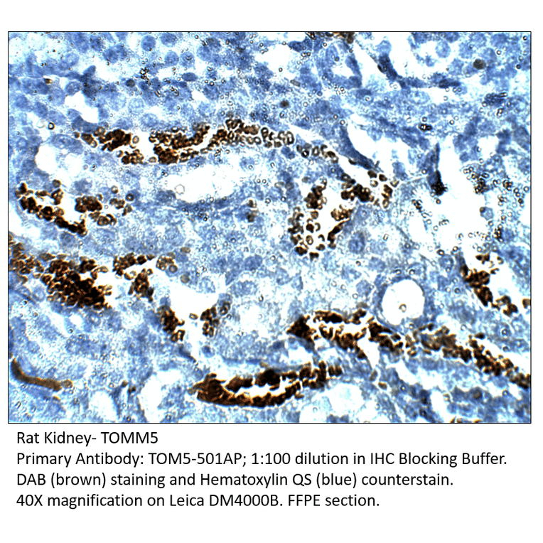 Anti-TOMM5 Antibody from FabGennix (TOM5-501AP) - Antibodies.com